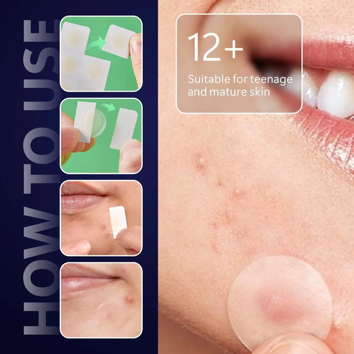 BlemishVeil Microcrystal Patches