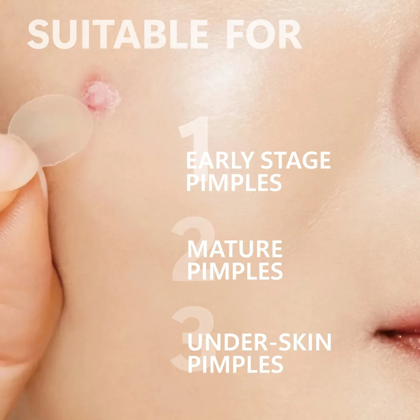BlemishVeil Microcrystal Patches